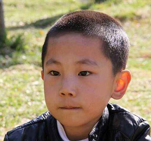 10岁小孩说话不清晰怎么办