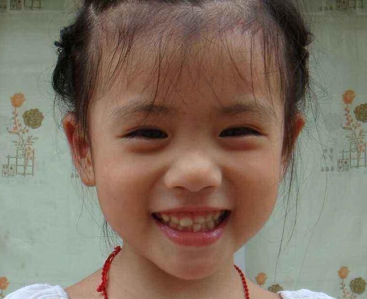 10岁小孩说话不清晰怎么办
